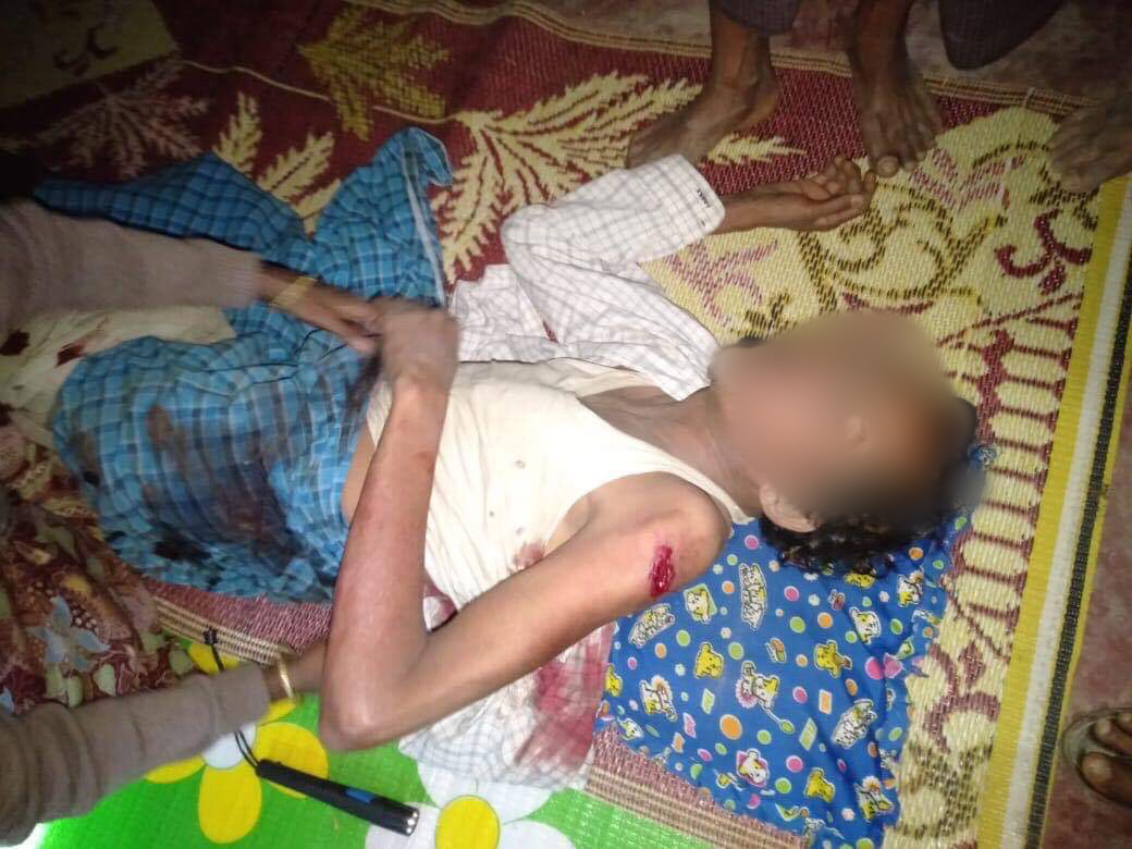 Rohingya Villagers Injured in Fights between Myanmar Military and Rakhine Rebels in Kyauktaw 