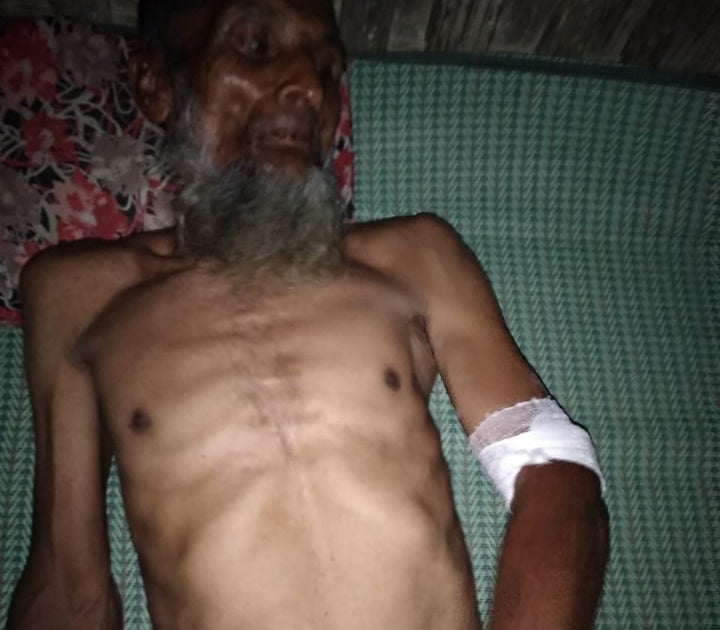 A Rohingya man was beaten and extorted 