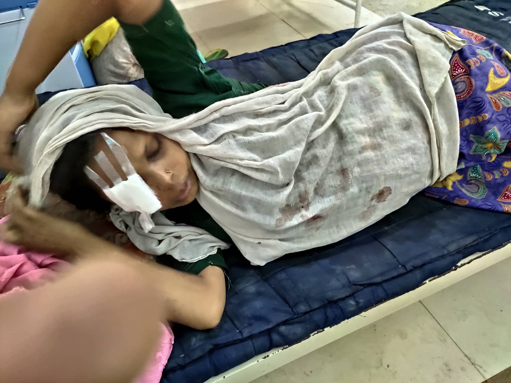 A woman hit by bullet in fighting between AA & Myanmar Army on 29 August 2019 in Buthidaung