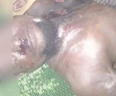 Rohingya man was killed near Battalion 541