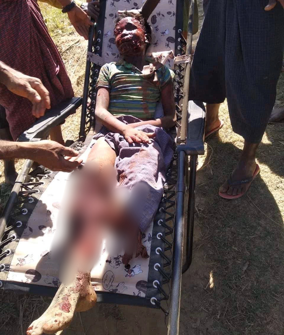 Landmine blast in Buthidaung