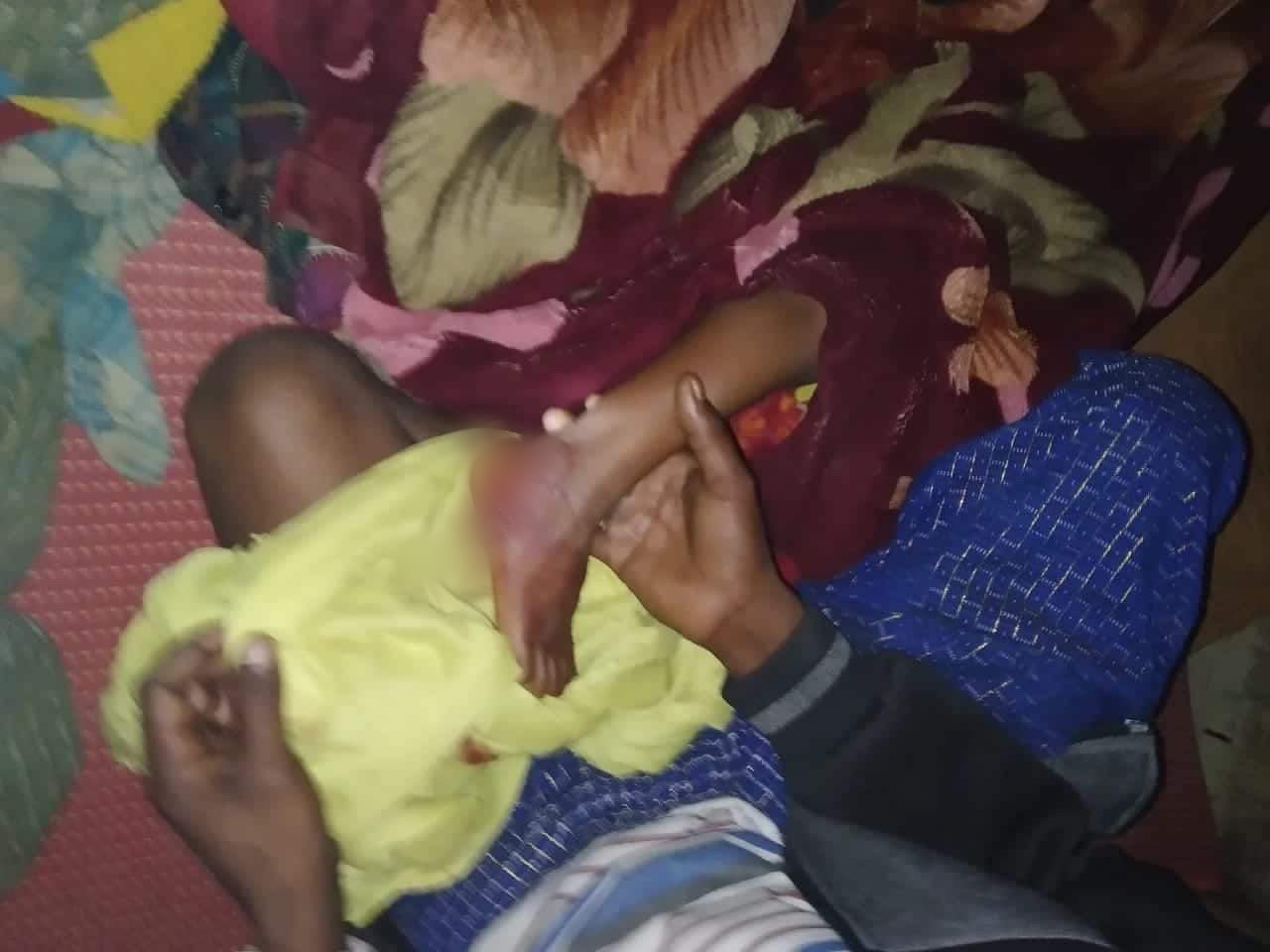 Two Rohingya women killed, 7 injured