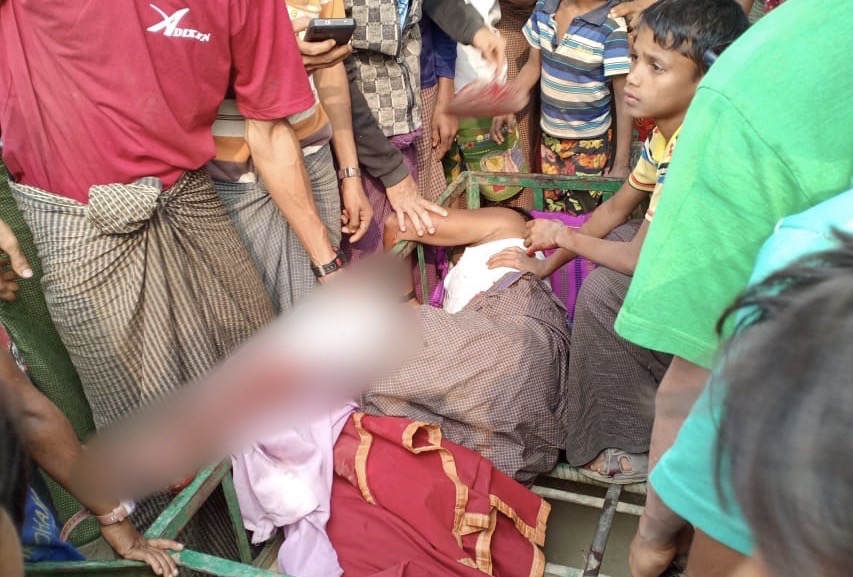 A Rohingya man hit by bullets