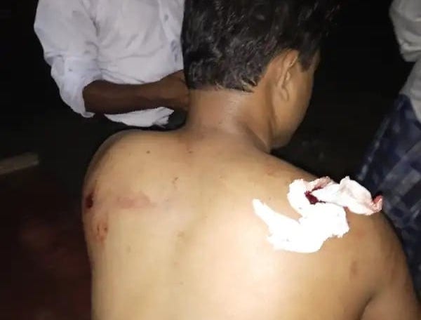 A Rohingya youth was shot by unknown gunmen 