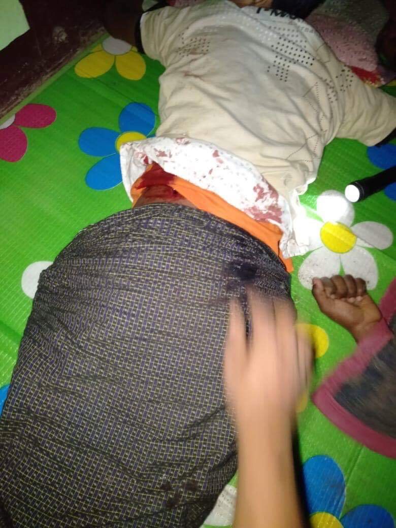 Rohingyas injured in fights between AA and Tatmadaw