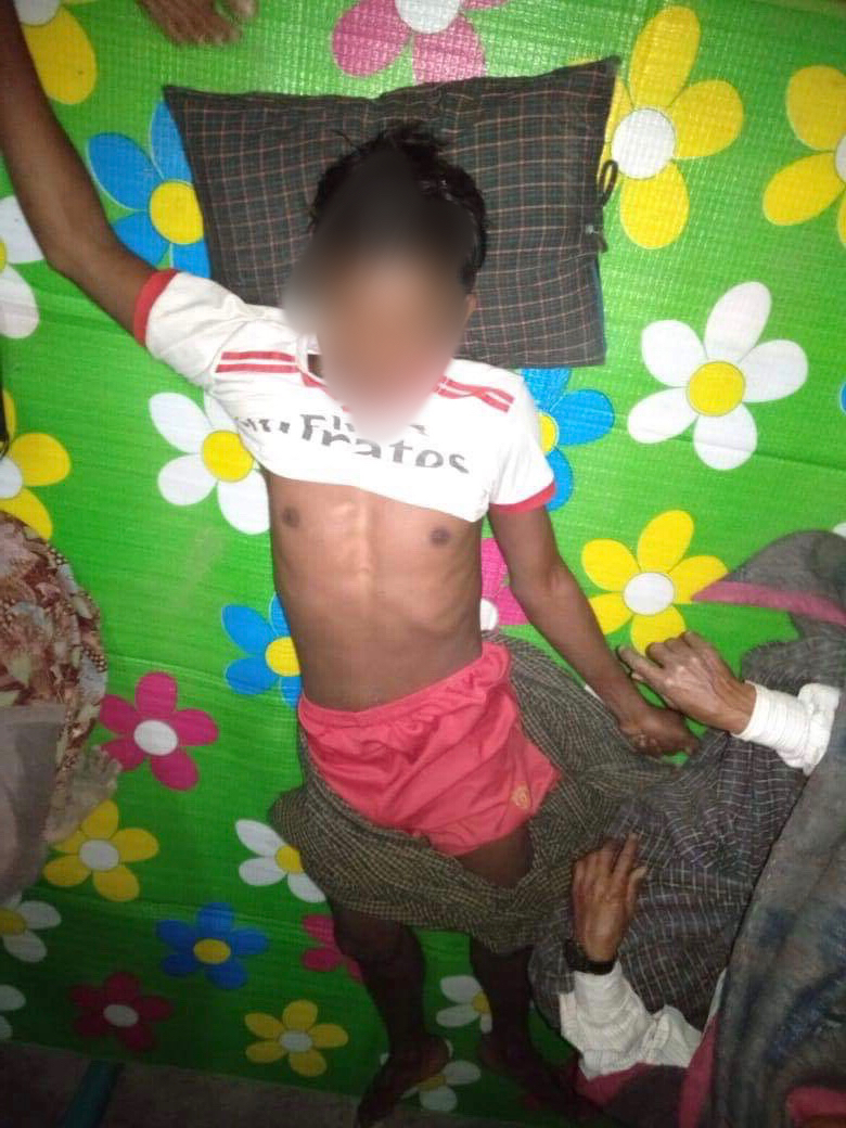 Rohingyas injured in fights between AA and Tatmadaw